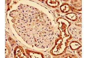 Immunohistochemistry (IHC) image for anti-Carbonic Anhydrase II (CA2) (AA 2-260) antibody (ABIN7146715)
