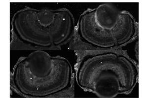 Sample Type:  Zebrafish Embryo   Dilution:  1:100, 1:200 (CDK5 antibody  (C-Term))