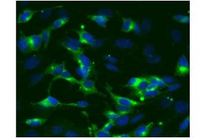 Immunofluorescence (IF) image for anti-Synaptophysin (SYP) (AA 205-306) antibody (ABIN968694) (Synaptophysin antibody  (AA 205-306))