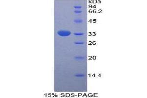SDS-PAGE (SDS) image for Fucosidase, alpha-L- 1, Tissue (FUCA1) (AA 170-420) protein (His tag) (ABIN2124887)