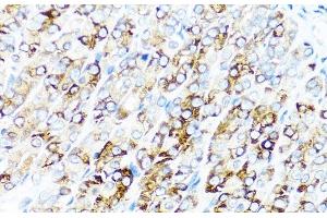 Immunohistochemistry of paraffin-embedded Mouse stomach using SERPINA7 Polyclonal Antibody at dilution of 1:100 (40x lens). (SERPINA7 antibody)