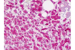 Human Pancreas: Formalin-Fixed, Paraffin-Embedded (FFPE) (ZIC4 antibody  (AA 299-334))