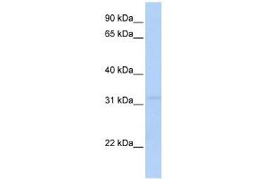 MTCH2 antibody used at 1 ug/ml to detect target protein.