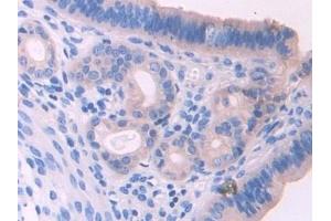 Detection of UMODL1 in Mouse Uterus Tissue using Polyclonal Antibody to Uromodulin Like Protein 1 (UMODL1) (UMODL1 antibody  (AA 34-306))