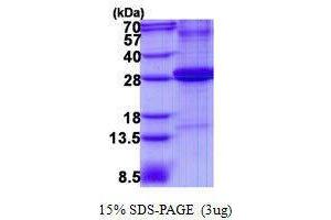 Figure annotation denotes ug of protein loaded and % gel used. (Adipsin Protein)