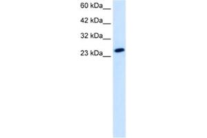 Western Blotting (WB) image for anti-TBP-Like 1 (TBPL1) antibody (ABIN2461203)