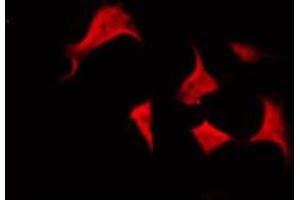 ABIN6266574 staining HepG2 by IF/ICC. (Cytokeratin 5 antibody  (C-Term))