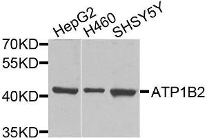 Western blot analysis of extracts of various cell lines, using ATP1B2 antibody. (ATP1B2 antibody  (AA 68-290))