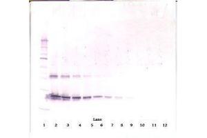 Image no. 1 for anti-Ciliary Neurotrophic Factor (CNTF) antibody (ABIN465750) (CNTF antibody)