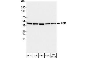 Western Blotting (WB) image for anti-Adenosine Kinase (ADK) (AA 312-362) antibody (ABIN7449946) (ADK antibody  (AA 312-362))