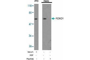 Western blot analysis of extract from 293 and Hela using FOXO1 polyclonal antibody  . (FOXO1 antibody)