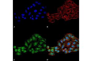 Immunocytochemistry/Immunofluorescence analysis using Rabbit Anti-WDR45 Polyclonal Antibody . (WDR45 antibody  (AA 312-322) (HRP))