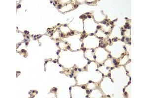 Immunohistochemistry of paraffin-embedded Mouse lung using GSS Polyclonal Antibody at dilution of 1:200 (40x lens). (Glutathione Synthetase antibody)