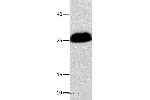 Western blot analysis of Huamn cervical cancer tissue , using BCL2L1 Polyclonal Antibody at dilution of 1:300 (BCL2L1 antibody)