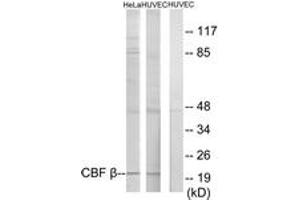 Western blot analysis of extracts from HuvEc/HeLa cells, using CBF beta Antibody. (CBFB antibody  (AA 11-60))