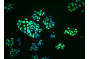 Immunoflourescent staining of PDX-1 in mouse pancreatic tumor (insulinoma) cells. (PDX1 antibody)