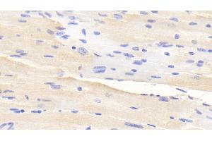 Immunohistochemistry (IHC) image for anti-ADAM Metallopeptidase with Thrombospondin Type 1 Motif, 2 (Adamts2) (AA 855-1030) antibody (ABIN7440095)