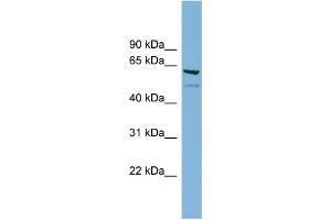 WB Suggested Anti-C7orf43 Antibody Titration: 0. (C7orf43 antibody  (Middle Region))