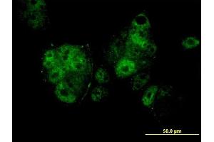 Immunofluorescence of monoclonal antibody to MEF2A on MCF-7 cell. (MEF2A antibody  (AA 71-170))