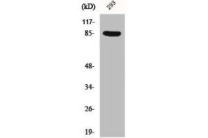 Western Blot analysis of 293 cells using Phospho-Cortactin (Y466) Polyclonal Antibody (Cortactin antibody  (pTyr466))