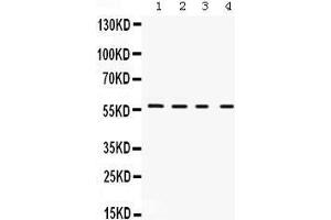 Western Blotting (WB) image for anti-Potassium Voltage-Gated Channel, Shaker-Related Subfamily, Member 2 (KCNA2) (AA 466-499), (C-Term) antibody (ABIN3043865)