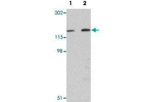 Western blot analysis of mouse skeletal muscle tissue with MYBPC2 polyclonal antibody  at (Lane 1) 1 and (Lane 2) 2 ug/mL dilution. (MYBPC2 antibody  (C-Term))