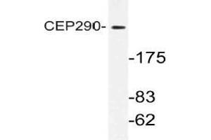 Western blot (WB) analysis of CEP290 antibody in extracts from K562 cells.