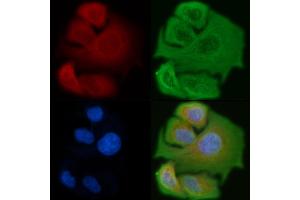 ABIN6257299 and ABIN6275373 staining Hela cells by IF/ICC. (KCNK17 antibody)