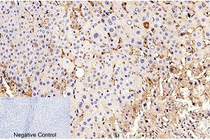 Immunohistochemical analysis of paraffin-embedded human liver tissue. (Caspase 9 p35 (AA 240-320), (Cleaved-Asp315) antibody)