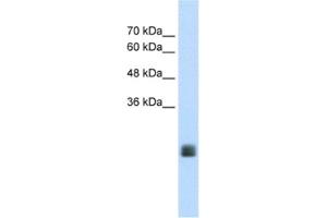 Western Blotting (WB) image for anti-Transmembrane Protein 178A (TMEM178A) antibody (ABIN2462646) (TMEM178 antibody)