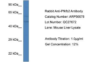 Western Blotting (WB) image for anti-6-phosphofructo-2-Kinase/fructose-2,6-Biphosphatase 2 (PFKFB2) (C-Term) antibody (ABIN2786834)