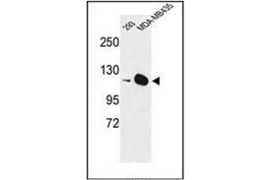 Western blot analysis of DIAPH2 Antibody  in 293, MDA-MB435 cell line lysates (35ug/lane). (DIAPH2 antibody  (Middle Region))