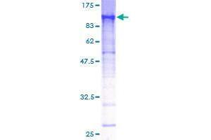 Image no. 1 for Ecdysoneless Homolog (ECD) (AA 1-644) protein (GST tag) (ABIN1352271) (ECD/SGT1 Protein (AA 1-644) (GST tag))
