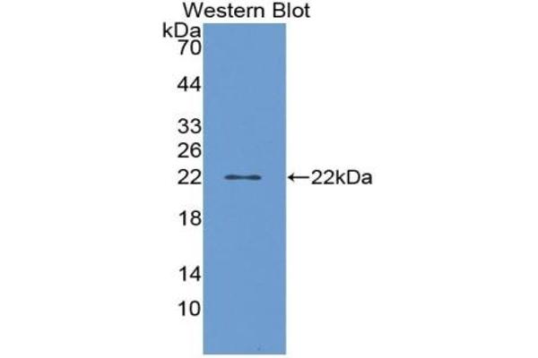 PTGDS antibody  (AA 32-190)