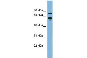 WB Suggested Anti-ABCF2 Antibody Titration:  0. (ABCF2 antibody  (N-Term))