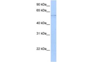 Western Blotting (WB) image for anti-Kynureninase (L-Kynurenine Hydrolase) (KYNU) antibody (ABIN2462923) (KYNU antibody)