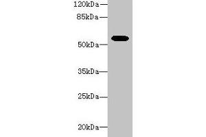 Western blot All lanes: Aldh1a1 antibody at 8 μg/mL + Mouse eye tissue Secondary Goat polyclonal to rabbit IgG at 1/10000 dilution Predicted band size: 55 kDa Observed band size: 55 kDa (ALDH1A1 antibody  (AA 2-501))