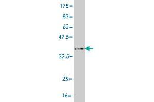 Western Blot detection against Immunogen (36. (PIM1 antibody  (AA 1-100))