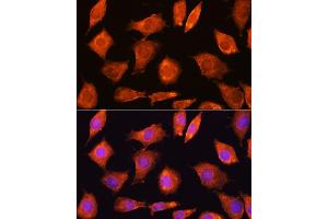 Immunofluorescence analysis of L929 cells using SEC11A Rabbit pAb (ABIN6133117, ABIN6147478, ABIN6147479 and ABIN6214843) at dilution of 1:100. (SEC11A antibody  (AA 37-145))