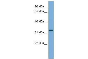 WB Suggested Anti-ATG3  Antibody Titration: 0. (ATG3 antibody  (Middle Region))