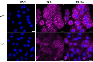 Immunocytochemical staining of HepG2 cells using EGFR antibody (ABIN7798461), 1:1,000), Top panel: wild-type (WT), Bottom panal: EGFR shRNA knockdown (KD). (Recombinant EGFR antibody)