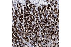 Immunohistochemical staining of human stomach with RSAD1 polyclonal antibody  shows strong cytoplasmic positivity in Parietal cells. (RSAD1 antibody)
