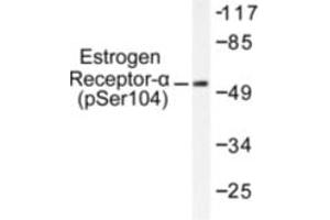 Image no. 2 for anti-Estrogen Receptor 1 (ESR1) (pSer104) antibody (ABIN318016) (Estrogen Receptor alpha antibody  (pSer104))
