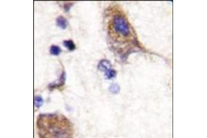 Formalin-fixed and paraffin-embedded human brain tissue reacted with SCYL2 (C-term), which was peroxidase-conjugated to the secondary antibody, followed by DAB staining. (SCYL2 antibody  (C-Term))