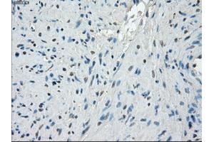 Immunohistochemical staining of paraffin-embedded endometrium tissue using anti-PPP5Cmouse monoclonal antibody. (PP5 antibody)