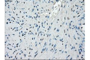Immunohistochemical staining of paraffin-embedded endometrium tissue using anti-PPP5Cmouse monoclonal antibody.