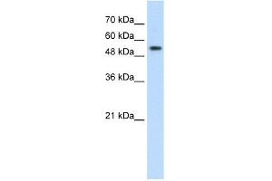 WB Suggested Anti-PRPF19 Antibody Titration:  2. (PRP19 antibody  (Middle Region))