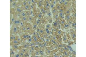 IHC-P analysis of liver tissue, with DAB staining. (TLR5 antibody  (AA 327-646))