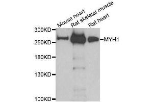 Western blot analysis of extracts of various cell lines, using MYH1 antibody. (MYH1 antibody  (AA 1-100))