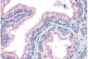 Human Prostate (formalin-fixed, paraffin-embedded) stained with NAB1 antibody ABIN462173 followed by biotinylated goat anti-rabbit IgG secondary antibody ABIN481713, alkaline phosphatase-streptavidin and chromogen. (NAB1 antibody  (AA 71-120))